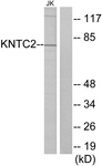 C10051-1 - NDC80