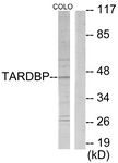 C10102-1 - TBX1