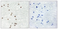 C10137-1 - ZIC1