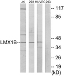 C10143-1 - LMX1B