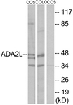 C10181-1 - TADA2L