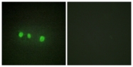 C10230-1 - ZIC1