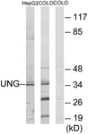 C10355-1 - Uracil-DNA glycosylase (UNG)