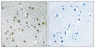 C10430-1 - TFE3