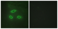C10518-1 - NKTR