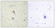 C10518-1 - NKTR