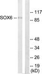 C10565-1 - SOX6