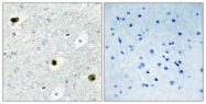 C10745-1 - TPD52