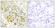 C10748-1 - DLX5