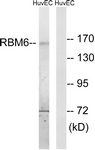 C10790-2 - RBM6