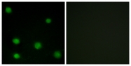 C10790-2 - RBM6