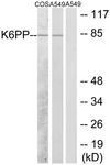 C10836-1 - PFKP