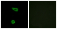 C10867-1 - TNFAIP2