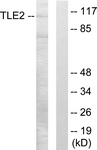 C10874-1 - TLE2