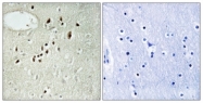 C10877-1 - EMX2
