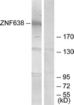 C11052-1 - ZNF638