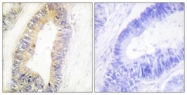 C11052-1 - ZNF638