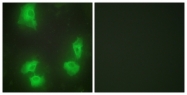 C11065-1 - CDK5R1