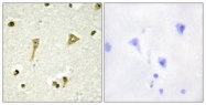 C11099-1 - TSC22D1