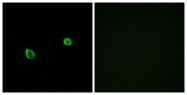 C11246-1 - ERN2 / IRE2