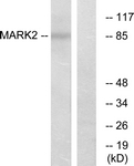 C11249-1 - MARK2