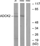 C11266-1 - ADCK2
