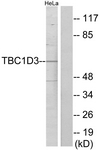 C11330-1 - TBC1D3