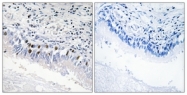 C11455-1 - MED12