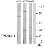 C11471-1 - TP53INP1