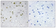 C11598-1 - NRIP2