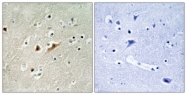 C11673-1 - RACGAP1