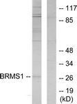 C11729-1 - BRMS1