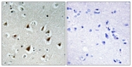 C11999-1 - ZHX2