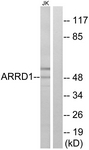 C12059-1 - ARRDC1
