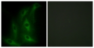 C12200-1 - Collagen type IV alpha 6 chain