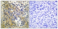C12200-1 - Collagen type IV alpha 6 chain