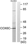 C12239-1 - Complex IV subunit VIc