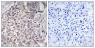 C12283-1 - CYP4F2