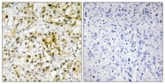 C13077-1 - Galectin-4
