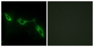 C13080-1 - Galectin-9