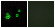 C13100-1 - PEA15
