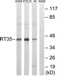 C14043-1 - MRPS35