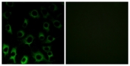 C14121-1 - RPS4X