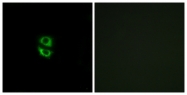 C14181-1 - RPL39