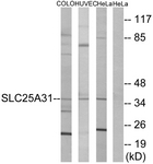 C14335-1 - SLC25A31