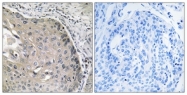 C14391-1 - Aldehyde oxidase