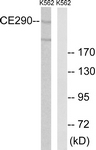 C15036-1 - CEP290