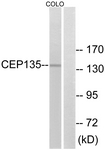 C15038-1 - CEP135