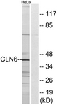 C15062-1 - CLN6