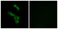 C15196-1 - C1q B subunit